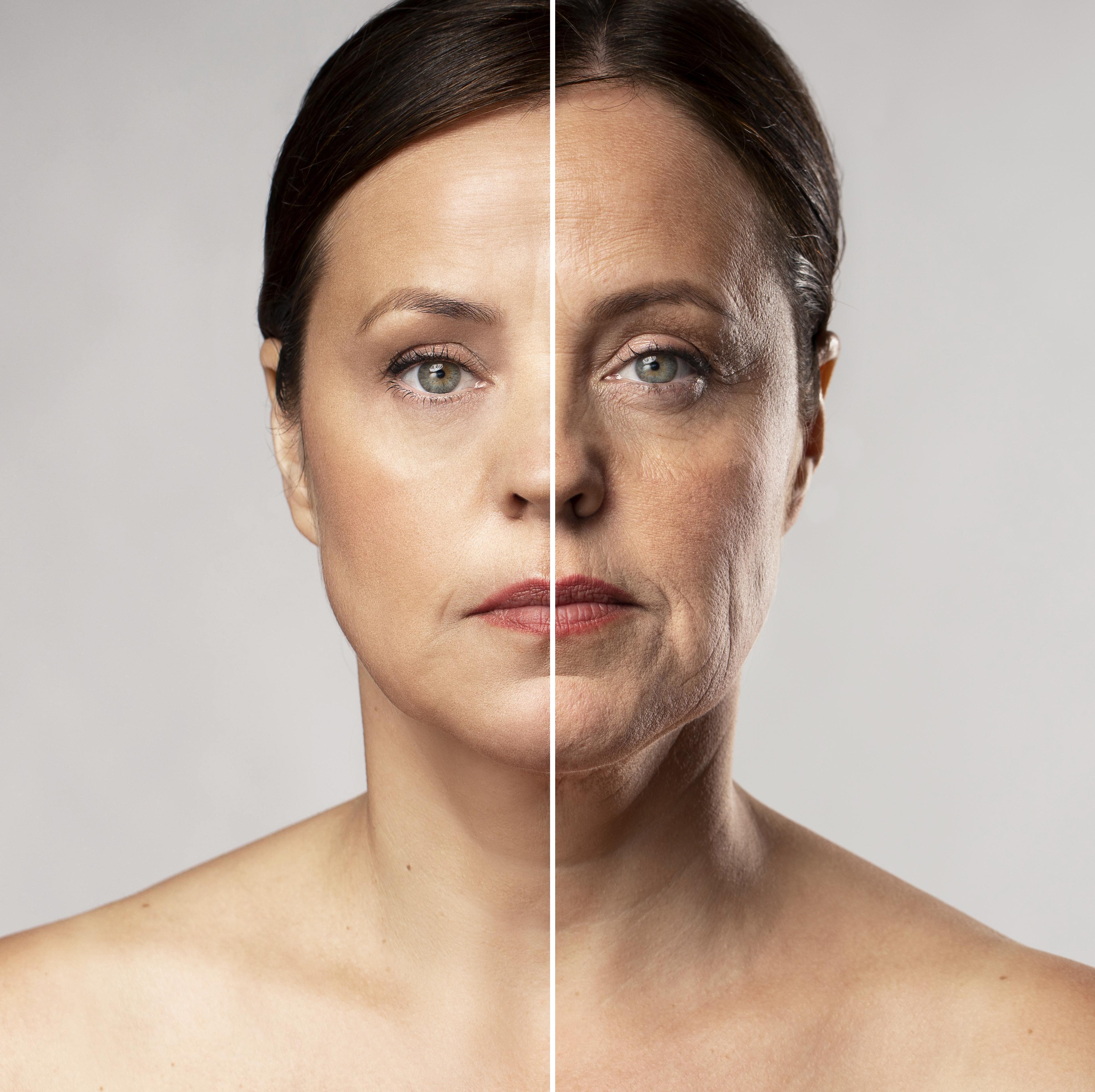 Tratamiento de Skinbooster Skinbooster